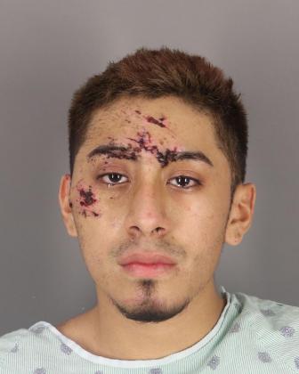 Luis Torres, pictured at 18, after the 2020 wreck 